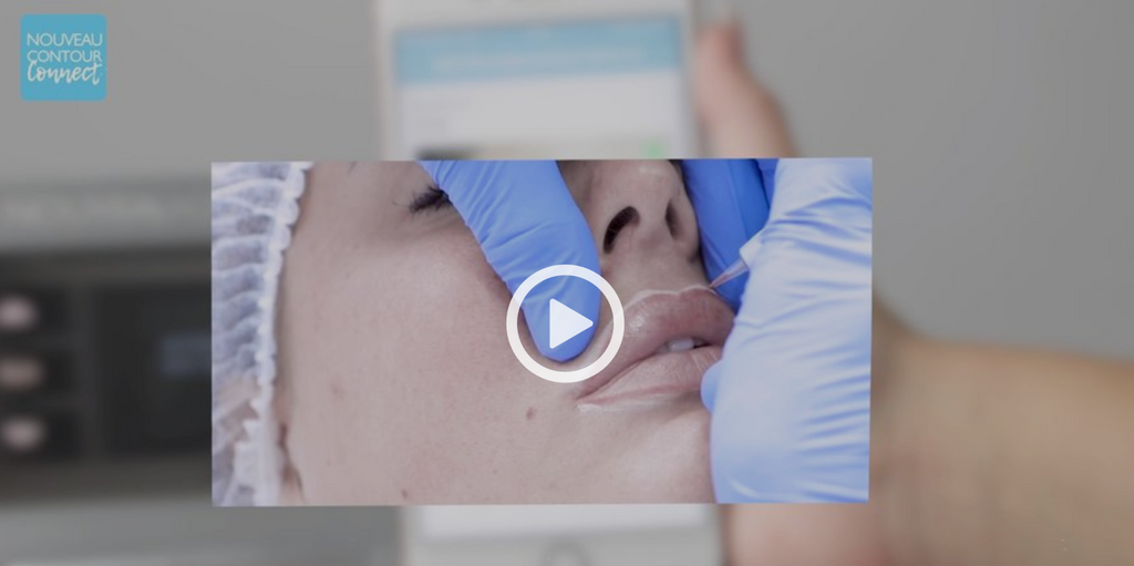 The Nouveau Contour Connect App